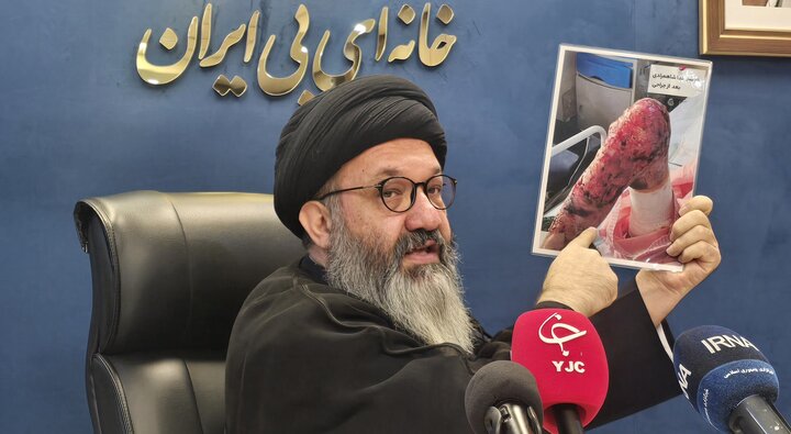 حدود ۱۲۵۰ بیمار «ای بی» در کشور شناسایی شده اند